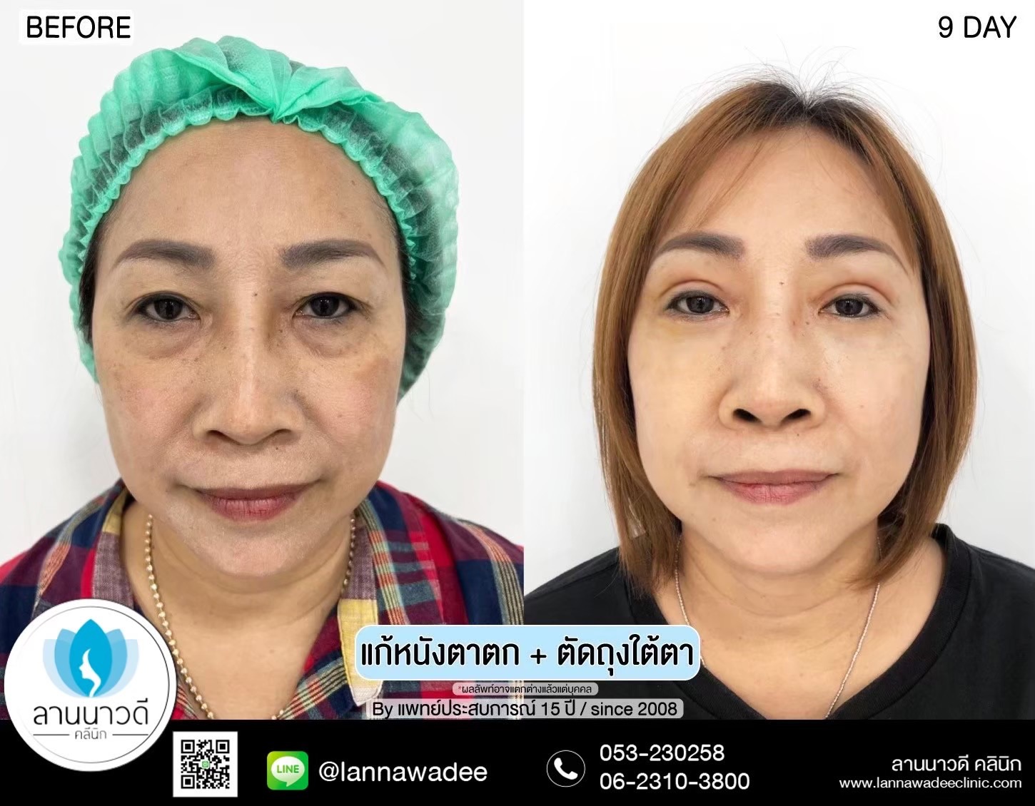 คลินิกศัลยกรรมความงาม