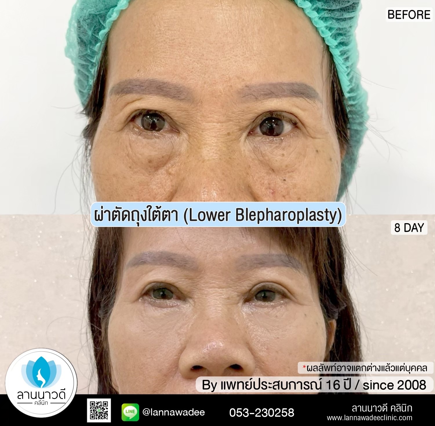 คลินิกศัลยกรรมความงาม