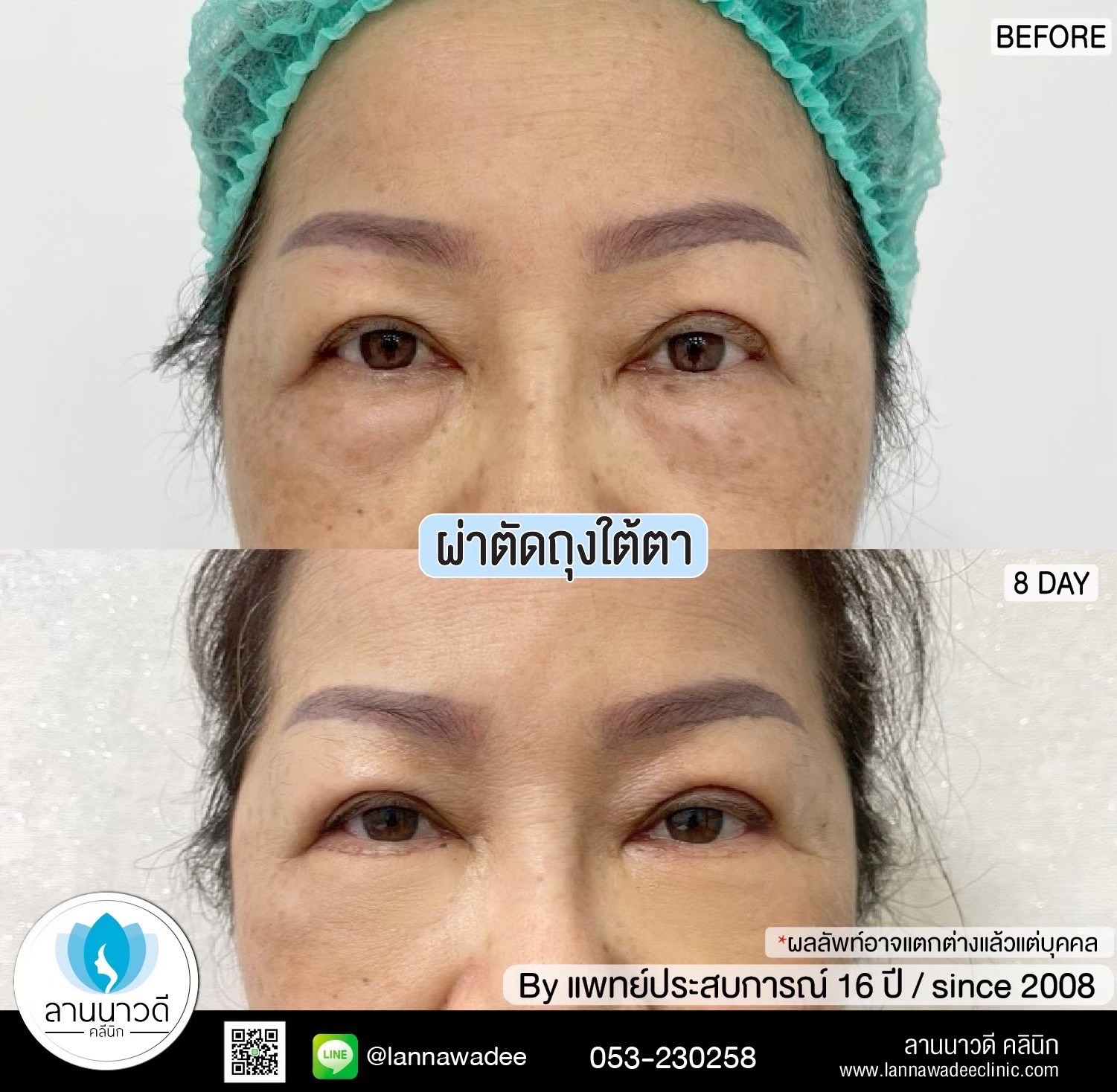 คลินิกศัลยกรรมความงาม