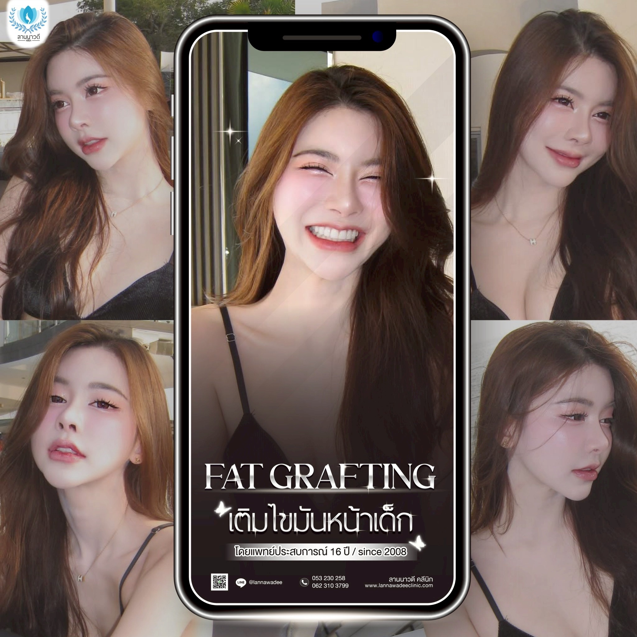 ฉีดหน้า