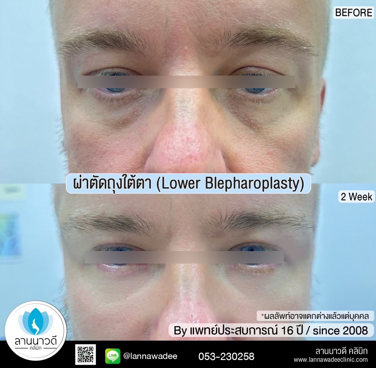 The best liposuction clinic