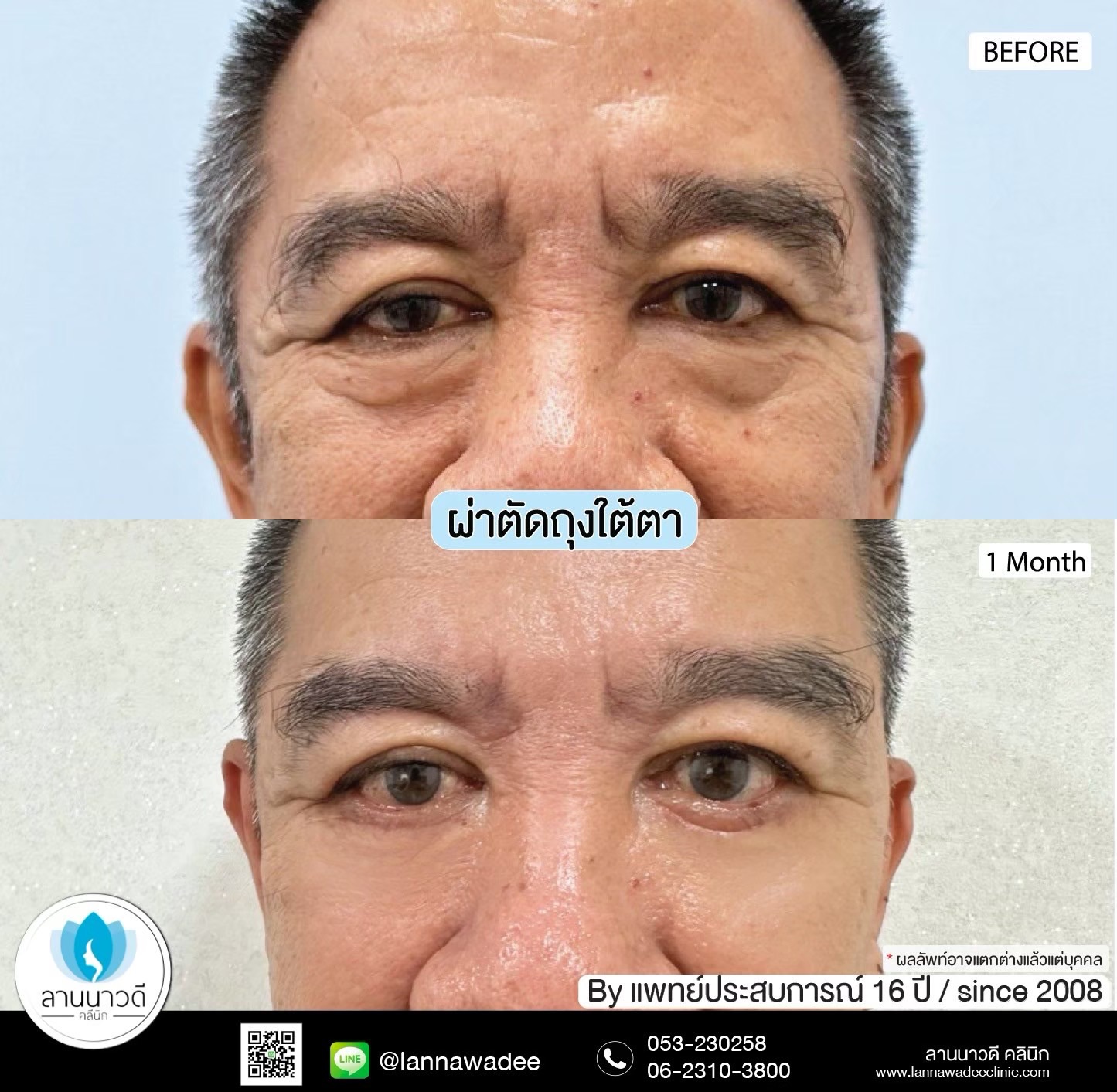 The best liposuction clinic