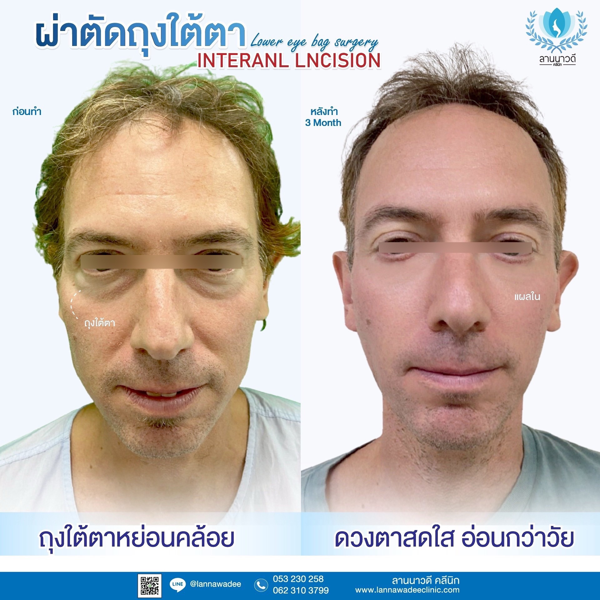 The best liposuction clinic