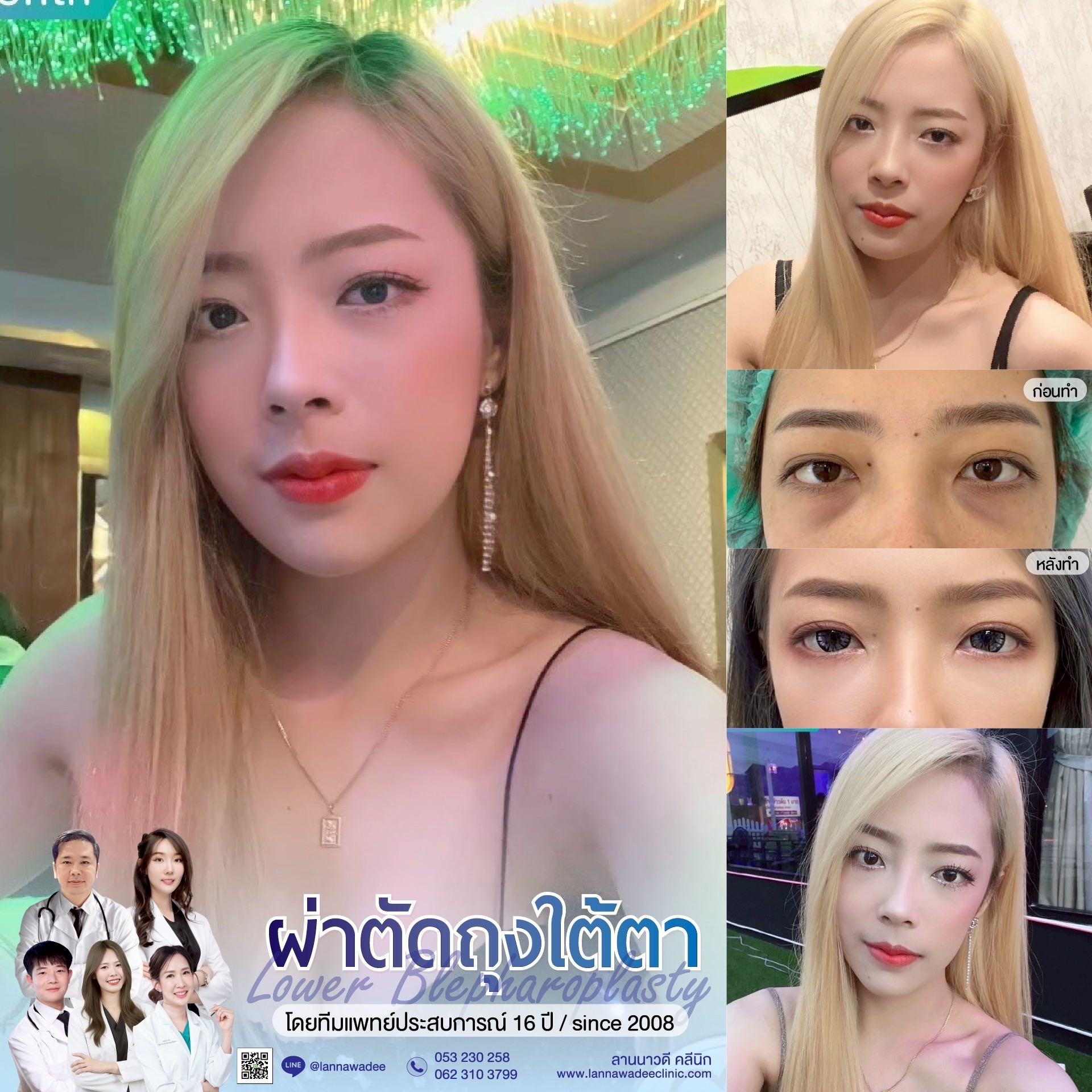 Aesthetic clinics in Chiang Mai